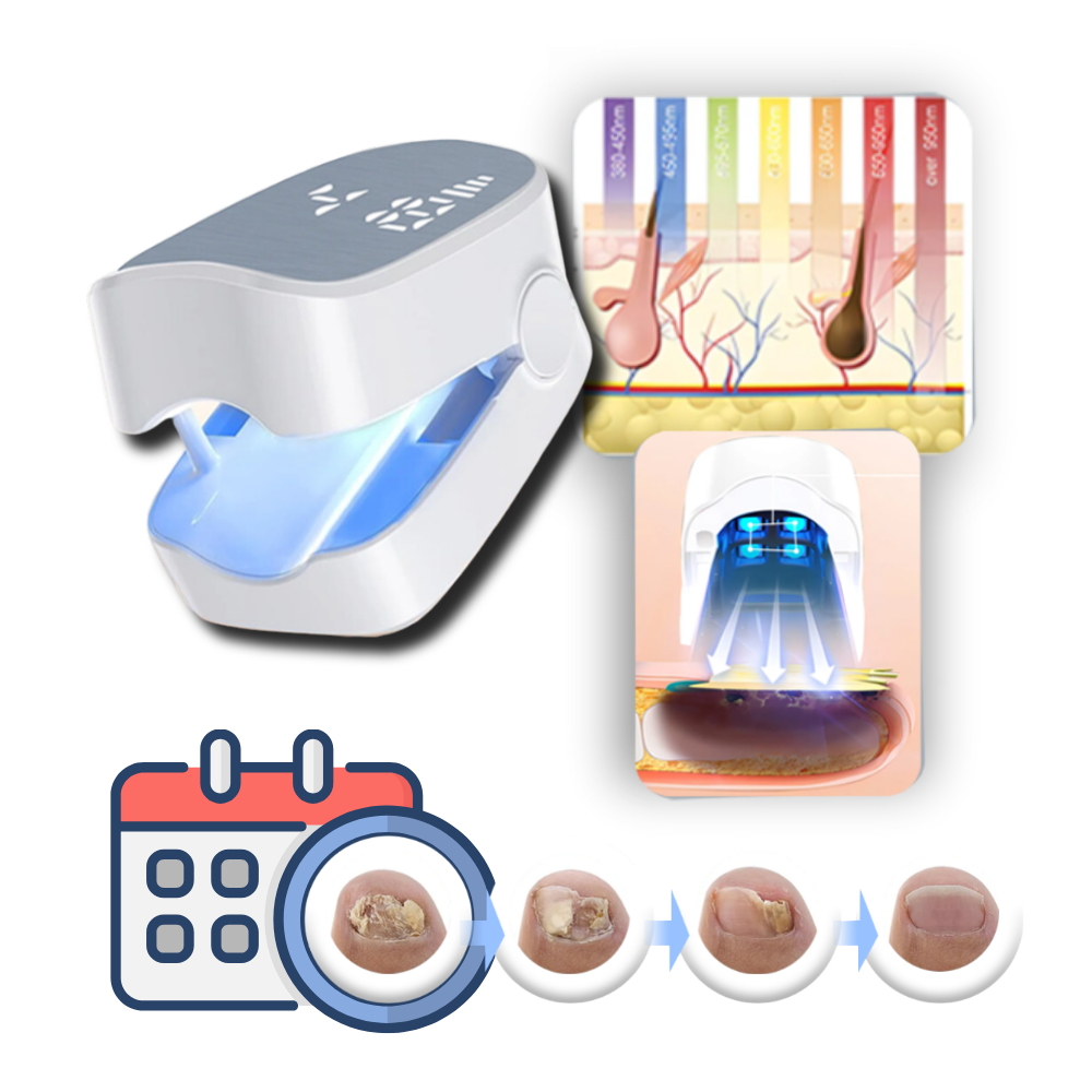 Dual Laser Nail Treatment Device with Ergonomic Clip and Rechargeable Battery