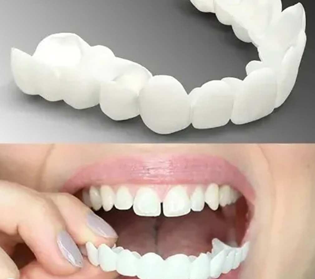 Snap-On Dentures with Micro Thin Polypropylene and Natural Tooth Color