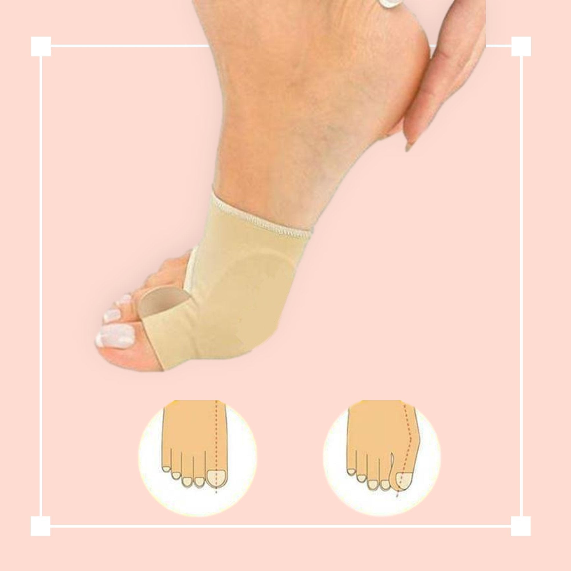 Bunion Corrector Sleeve with Toe Separator Pad and Hypoallergenic Material