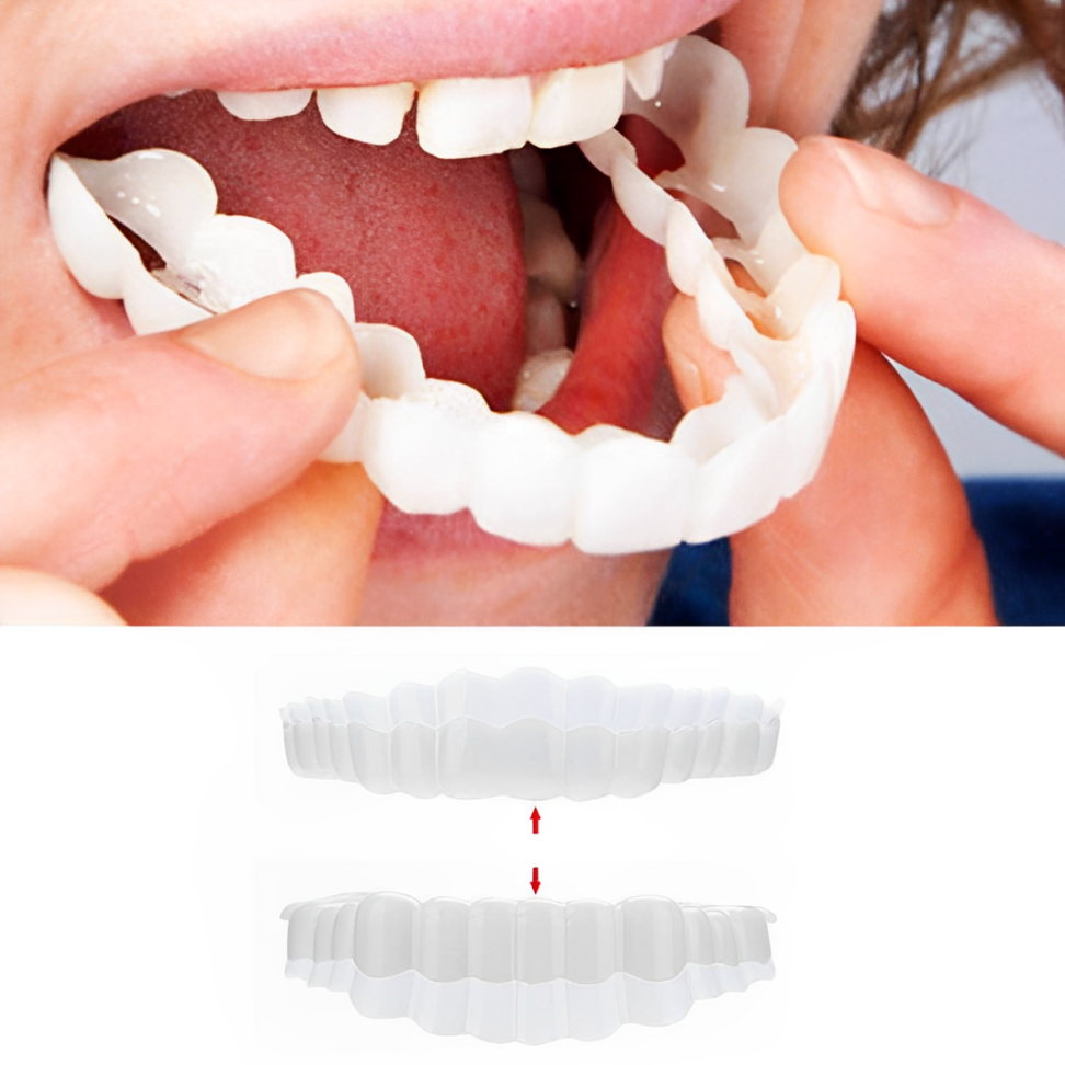 Clip On Veneer with Heat Molding Strip and Tweezers for Upper and Lower Teeth