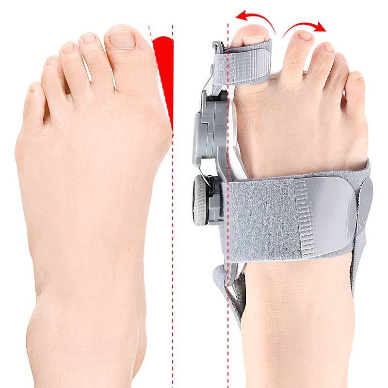 Adjustable Toe Spacer with Hinge Joint and Silicone Cushioning, Universal Fit