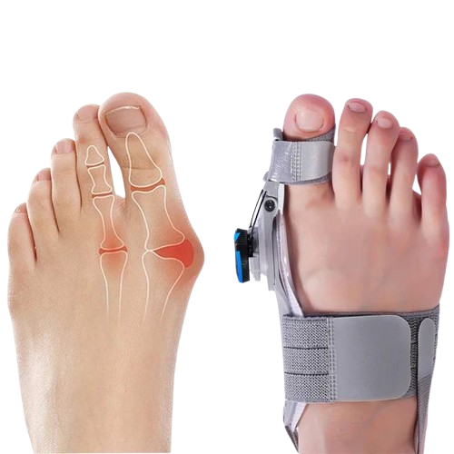 Adjustable Toe Spacer with Hinge Joint and Silicone Cushioning, Universal Fit