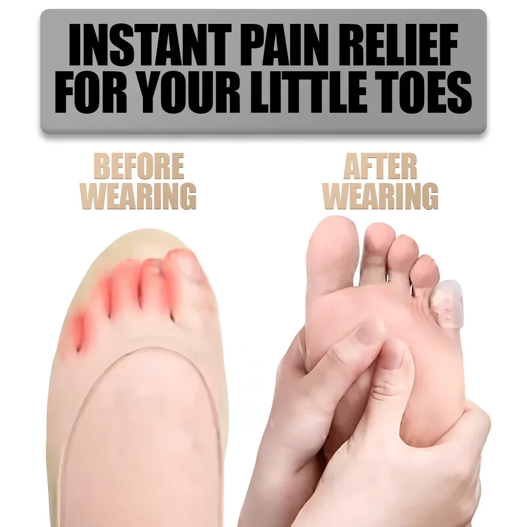 Clear Silicone Toe Protectors with Latex-Free Material, Set of 10