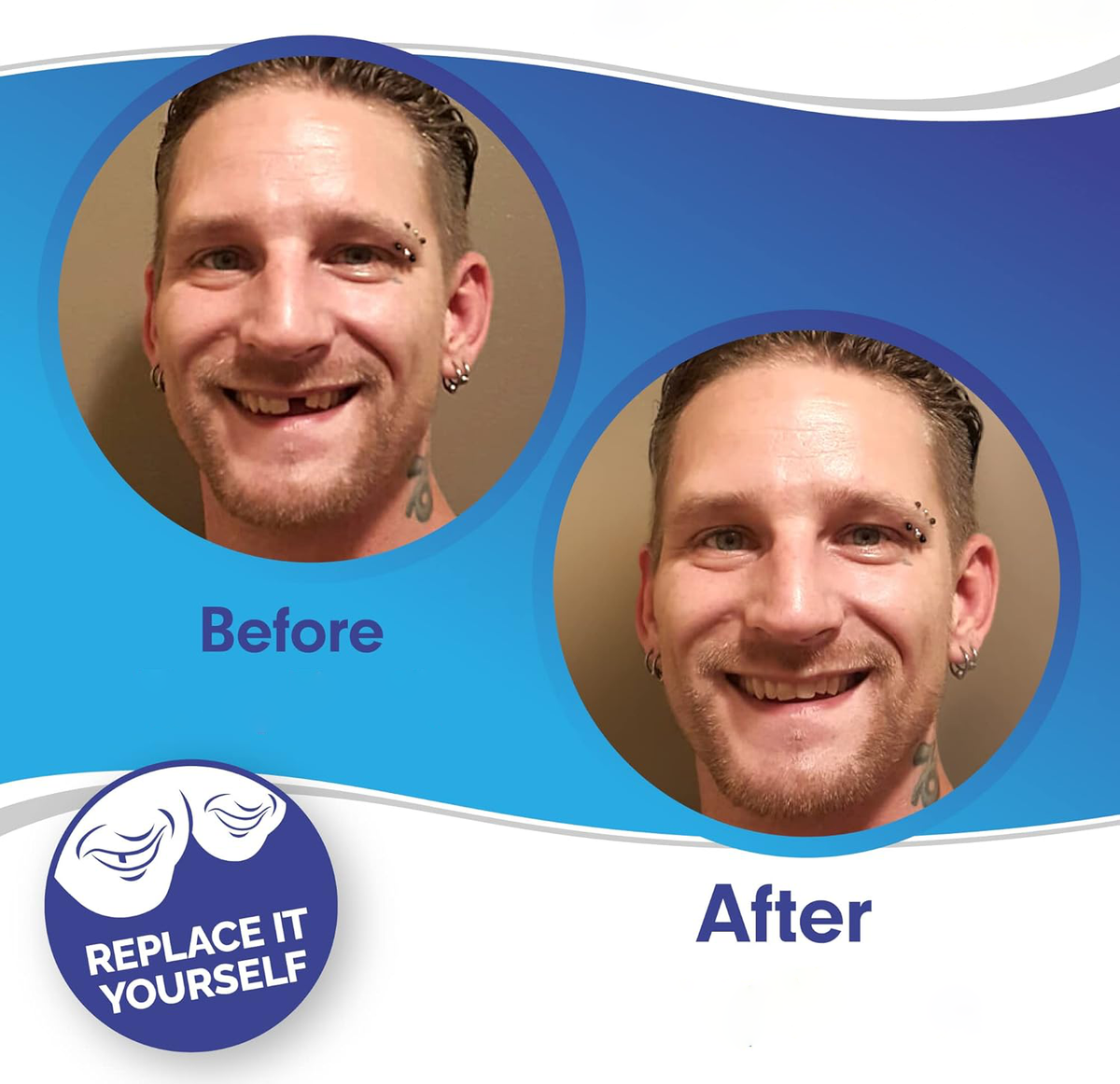 Clip On Veneer with Heat Molding Strip and Tweezers for Upper and Lower Teeth