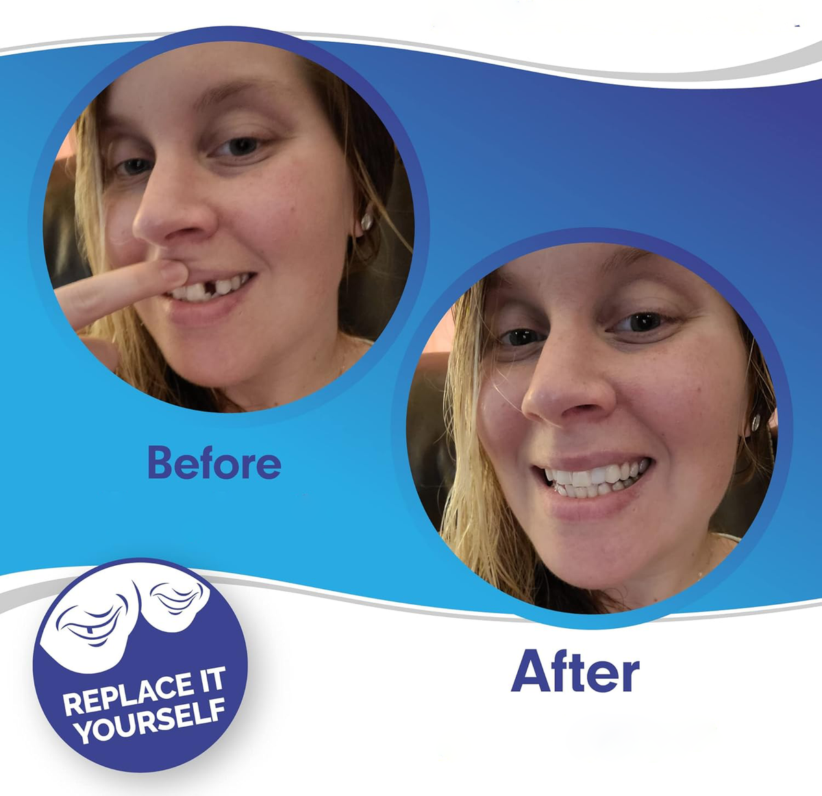 Clip On Veneer with Heat Molding Strip and Tweezers for Upper and Lower Teeth