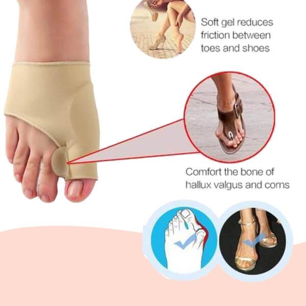 Bunion Corrector Sleeve with Toe Separator Pad and Hypoallergenic Material
