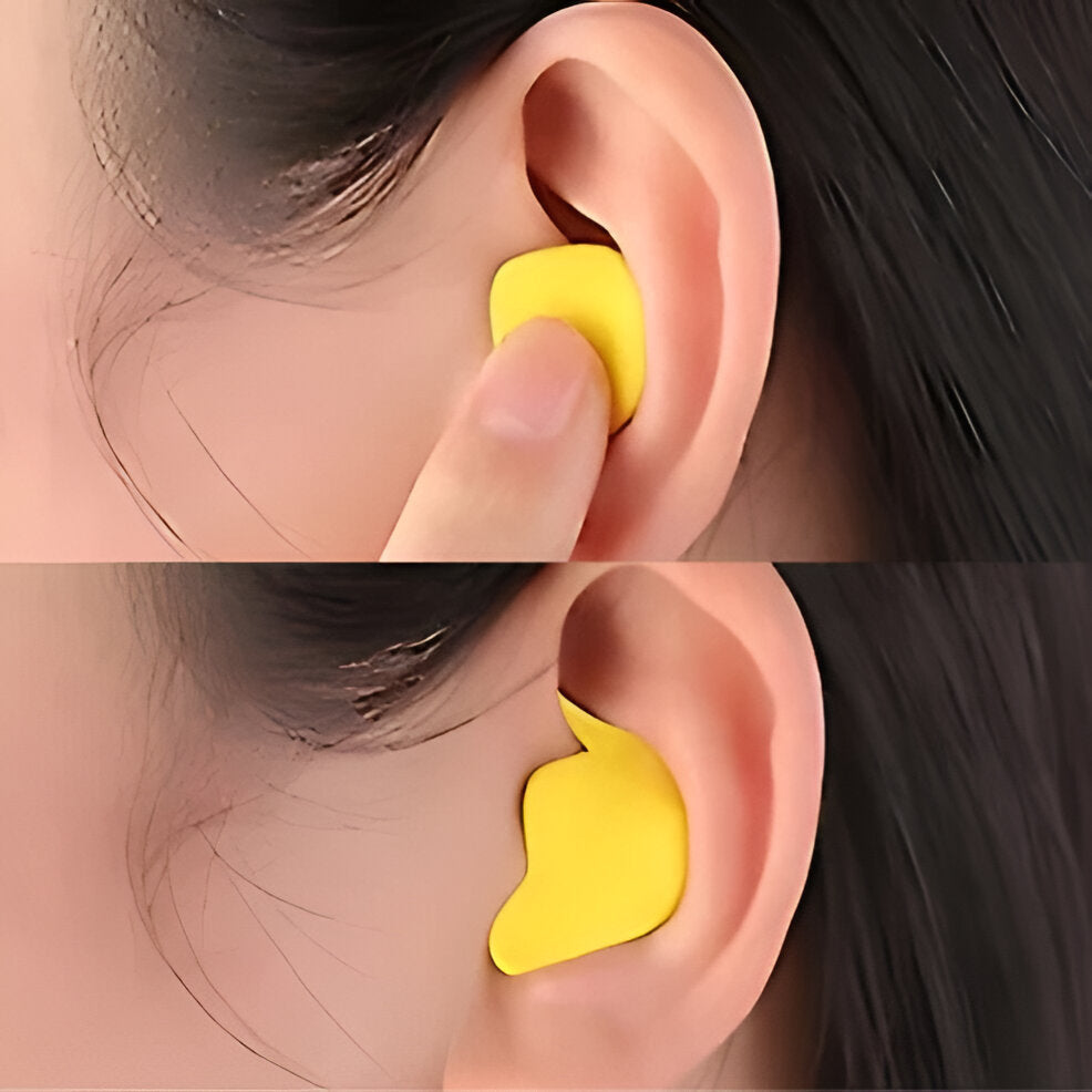 Moldable Silicone Earplugs with 95% Noise Reduction and Hypoallergenic Design