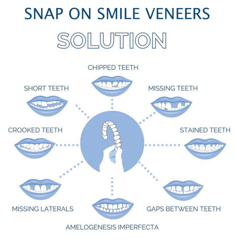 Clip On Veneer with Heat Molding Strip and Tweezers for Upper and Lower Teeth