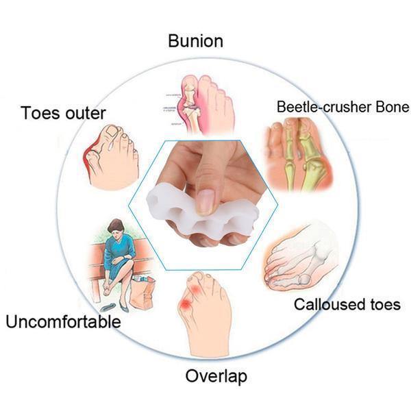 Adjustable Toe Corrector with Gel Pad Cushioning and Arch Support